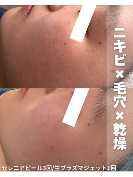 セレニア ボーテ(Selenia Beaute)/