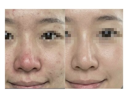 ヴィノ フクシマ(VINO fukushima)の写真