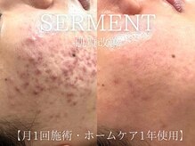 サロンドペオニー 川内店(salon de peony)