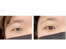 スウィートラッシュ 久喜テラレス店(Sweet Lash)/*Double eyelift*