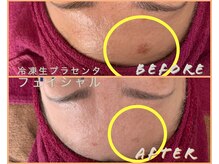 シストワ(sistoi)/《Before→After》