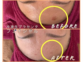 シストワ(sistoi)/《Before→After》