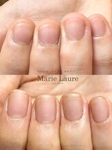 マリーロール 梅田店(Marie Laure)/自爪育成/深爪矯正/ネイルケア
