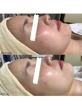 フォーユー マシバメディカル(For You Mashiba Medical)/エンビロンフェイシャル