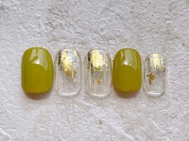 ¥9200/定額/ワイヤー