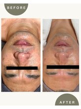 ビーカーブス 三鷹(B.curves)/before・after