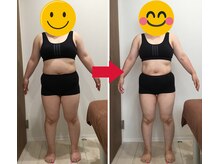 美容整体院元 光の森店/40代Y.F様のビフォーアフター