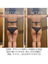 ヨサパーク サンテ 祐天寺(YOSA PARK sante)/痩身/ダイエット/よもぎ蒸し痩身