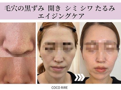 ココリールの写真