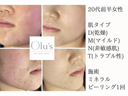 オルズ(Olu's)の写真