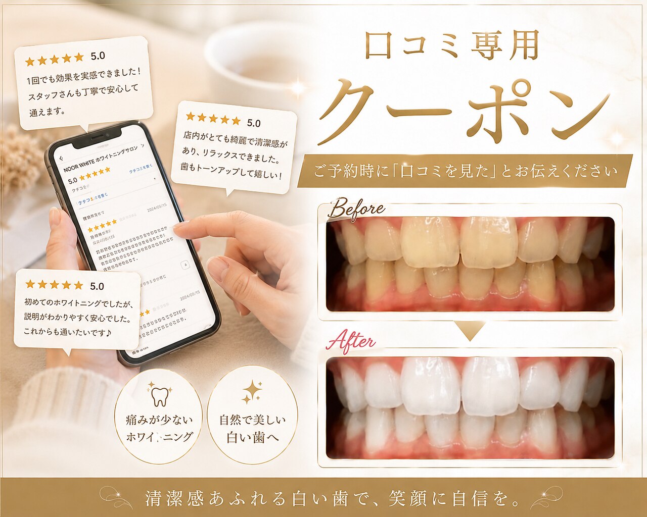 【医療提携】ホワイトニングメニュー導入　単品可 クーポン・メニュー｜ヌールホワイト 御徒町店(NOOR WHITE