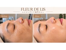 フルールドリス(FLEUR DE LIS)の雰囲気（フェイシャル全メニュー◎ヘッド・デコルテ・首肩マッサージ付♪）