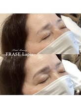 フレイズラピス(FRASE Lapis)/【ハリウッドブロウリフト】