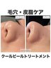 【押し出さない毛穴ケア・ニキビケア】頑固な悩みに◎黒ずみ／ざらつき