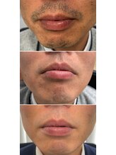 ゴールドプラス 伊勢店(GOLD PLUS)/BeforeAfter