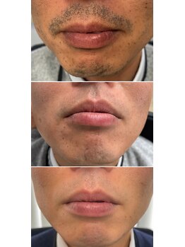 ゴールドプラス 伊勢店(GOLD PLUS)/BeforeAfter