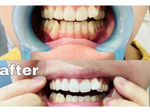 ココスターリー(Coco starry)/1度の体験で2～7トーンアップ☆