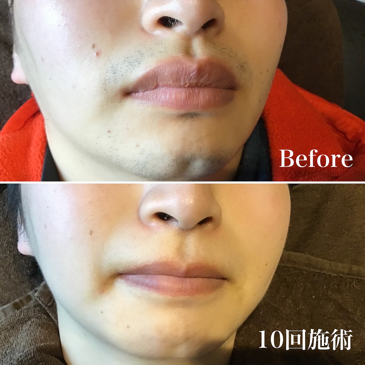 パーマネント バケーション(permanent vacation