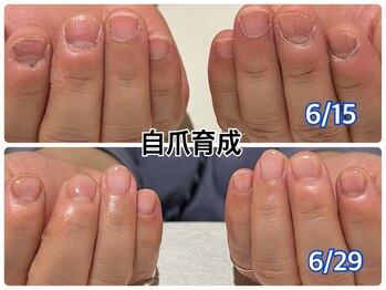 ジョワイユ(JOYEUX)の写真/【爪のお悩みなら当サロンへ！】資格保持者がお客様のお悩みに寄り添って施術をさせて頂きます。