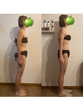 ララルアナ(Lara luana)/美姿勢に導くバストケア