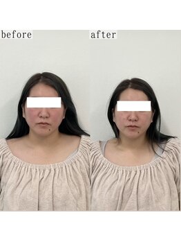 ヴェルシック(Belchic)/他店で満足出来なかった方にも