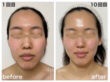 ダルセーニョ/ピュアな美しさが、すぐそこに！