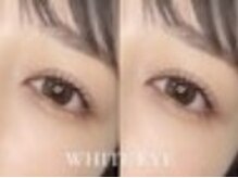 ホワイトアイ 平塚(WHITE EYE)/[平塚]まつげパーマ/マツパ