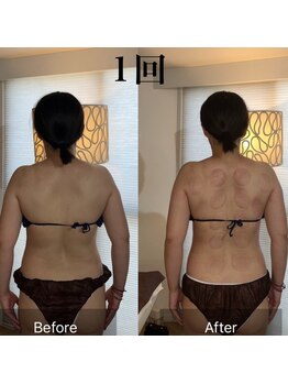 ウラヤス 恵比寿(Urayasu)/筋膜リリース