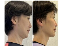 整体院トゥルース/たるんだお顔を姿勢から