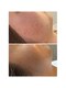ティースタイル 赤坂(T style)の写真/【毛穴・黒ずみ改善したい方に】クレンジング→泡洗顔→ウオーターピーリング→吸引→パック→仕上げに..
