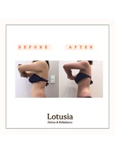 ルトゥーシア(Lotusia)/上半身　before→after