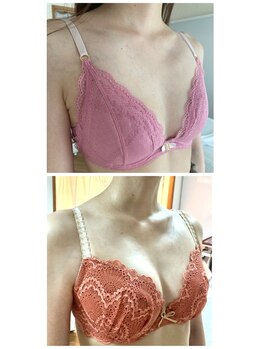 サロン ド チョコ(SALON DU CHOCO)/【バストアップ】症例