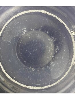 MTサロン 柏店/毛穴洗浄の汚れで肌状態をェック