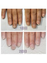 グレースレディ 神戸北店/