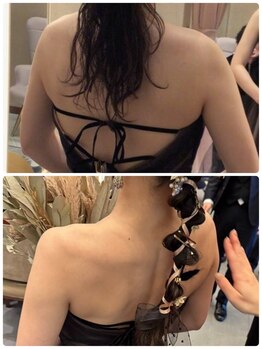 美やせ専門店 ビープロデュース 西尾店(B'PRODUCE)/【ブライダル】ビフォーアフター