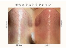 サロンドエー 帝塚山(Salon de A)/毛穴美人になろう！！