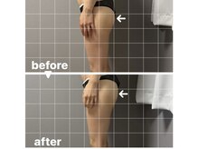 メゾン ド クロエ(Maison de Chloe)/CHLOE式パーソナル痩身