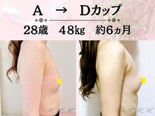 メディカルサロン エム エム エム 大阪梅田グランドサロン(M.M.M)の雰囲気（発育阻害因子を徹底改善！だから痩せ型さんでもバストアップ可能）