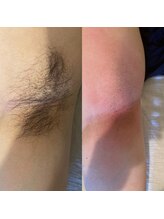 ララルアナ(Lara luana)/脇スッキリ！清潔感