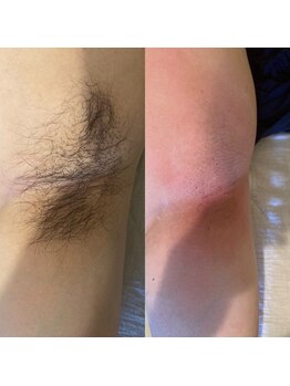 ララルアナ(Lara luana)/脇スッキリ!清潔感