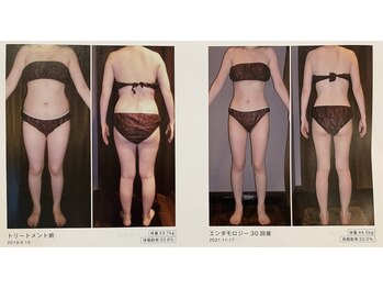 シェリール(Cherir)/エンダモロジー