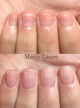 マリーロール 淀屋橋本店(Marie Laure)/自爪育成/深爪矯正/ネイルケア