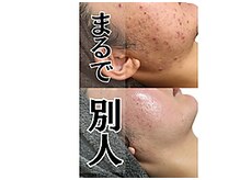 西新宿アンドマインドプラス(&mind+)の雰囲気（肌で人生激変された方続出【感動のクチコミはクチコミページへ】）
