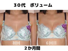 バストサロン メルベイユ(Merveile)/ボリュームUP・谷間UP