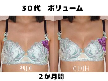 バストサロン メルベイユ(Merveile)/ボリュームUP・谷間UP