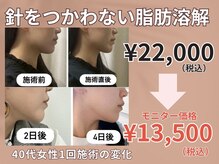 針を使わない脂肪分解で半永久的に脂肪とさよならしませんか？