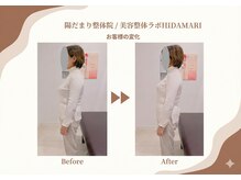 陽だまり整体院/お客様のビフォーアフター♪