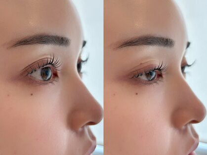 ガーデン(Garden)の写真