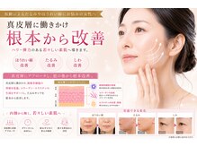 キートス(Kiitos)の雰囲気（真皮層から肌質改善/小顔/毛穴,黒ずみ/しみ/しわ/たるみ改善◎）