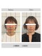 ソルヴィス 根本(soLvis)の写真/どうにもならない長年の食いしばり【ガチガチエラ張り】【老け顔】【顔の左右差】を丁寧にほぐし小顔に！